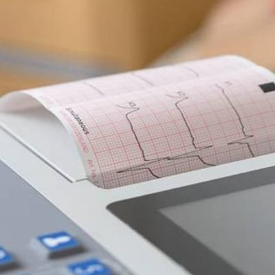 deroulement ecg